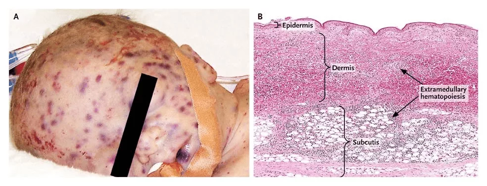 1695927325 80 ایدز و اچ‌آی‌وی چیست.webp