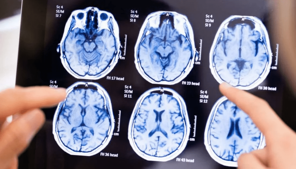 1695927325 921 ایدز و اچ‌آی‌وی چیست