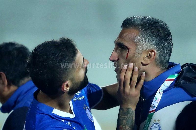 1702675550 هاشمی نسب با سر خونین آزادی را ترک کرد ویدیو