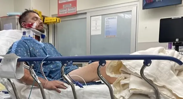 لحظه انفجار آرپیجی در دستان یک یوتیوبر و شکستگی جمجمه و خونریزی مغزی او 