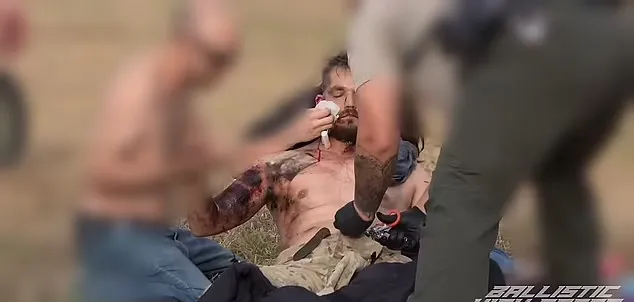 لحظه انفجار آرپیجی در دستان یک یوتیوبر و شکستگی جمجمه و خونریزی مغزی او 