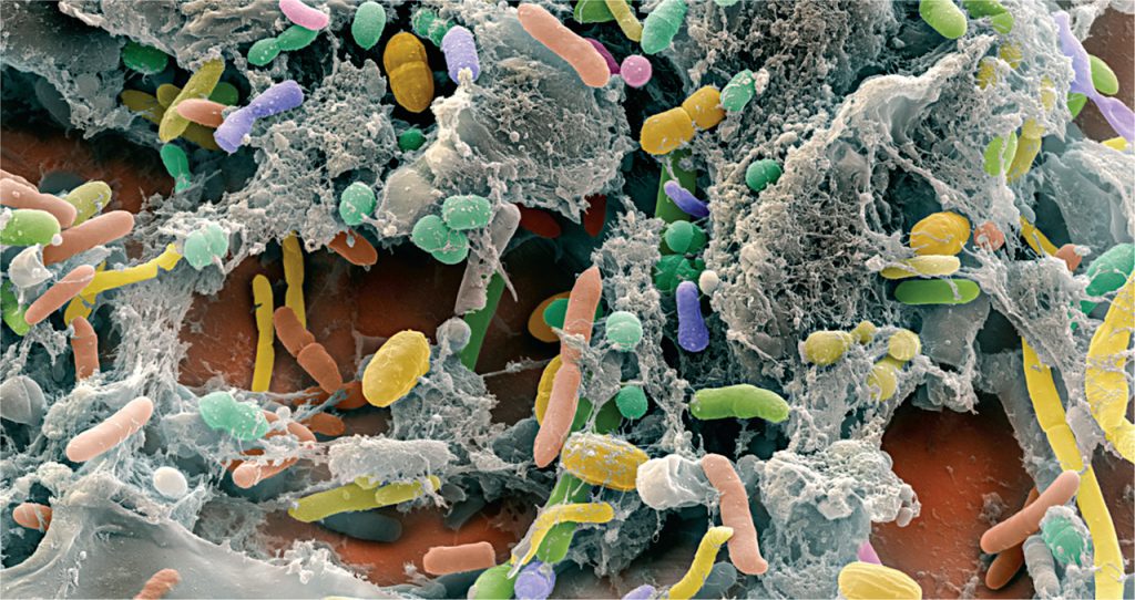 محققان موجودات کاملاً ناشناخته‌ای در دستگاه گوارش انسان کشف کردند