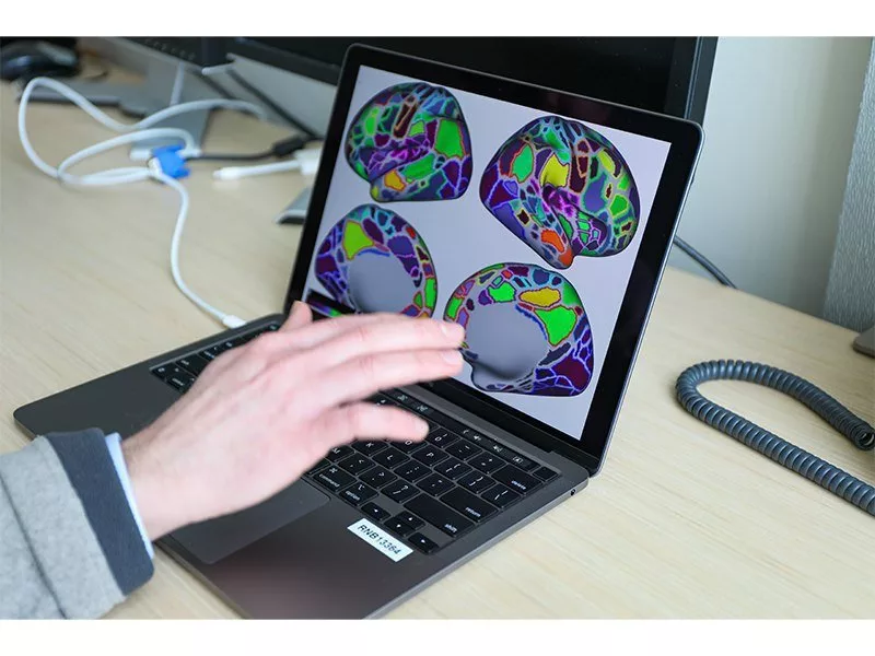 اختلال شایع ADHD بر اتصالات سراسر مغز تأثیر می‌گذارد.webp