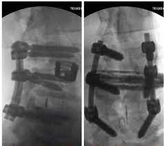 1711169612 220 رونی کلمن با ۸ گفتن مستر المپیا اکنون نمی تواند