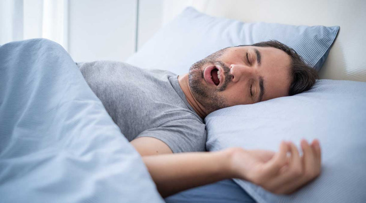 انحراف بینی؛ هرآنچه باید بدانید_آفتاب وطن 9 ارتباط انحراف بینی و آپنه خواب