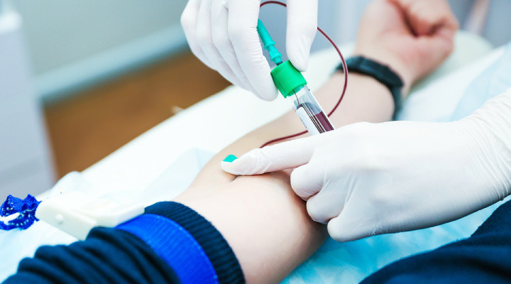 الیگومنوره؛ آنچه باید درمورد قاعدگی نامنظم بدانید_آفتاب وطن 6 الیگومنوره - آزمایشهای مربوط به الیگومنوره