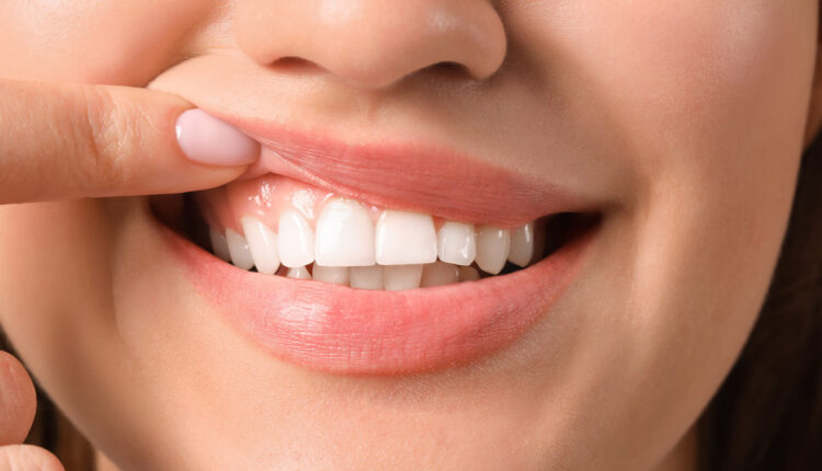 1724657645 993 اگر روزی یک عدد موز بخوریم، چه اتفاقی می‌افتد؟ آفتاب وطن